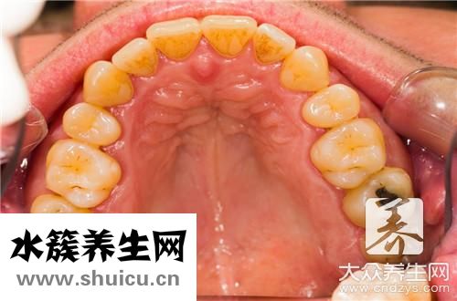 牙上有黑线