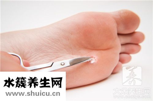 尖锐疣会自己消失
