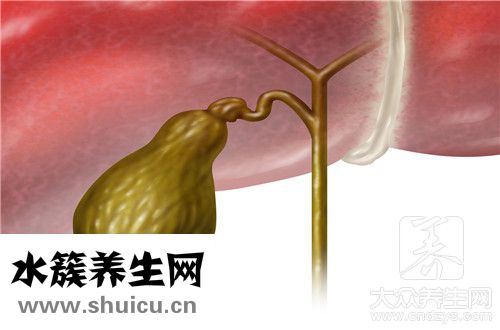 胆结石微创手术