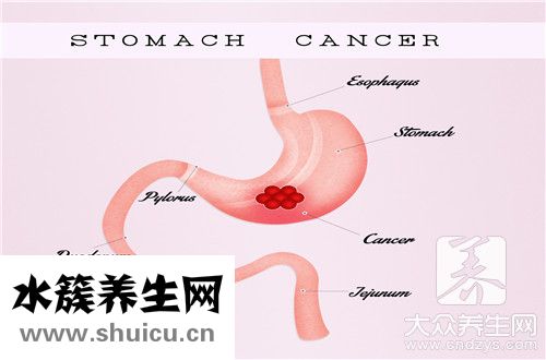 胃镜取活检