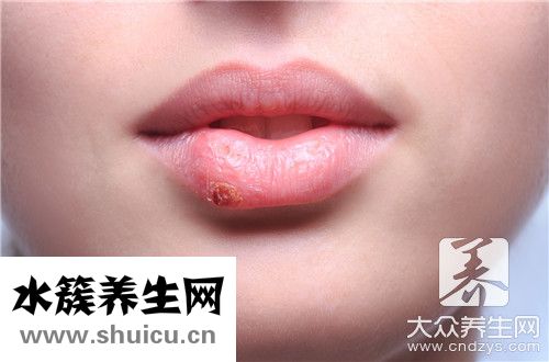 嘴唇干裂快速恢复
