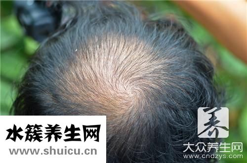 才能长头发