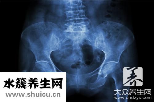 骨盆前倾多久可以恢复