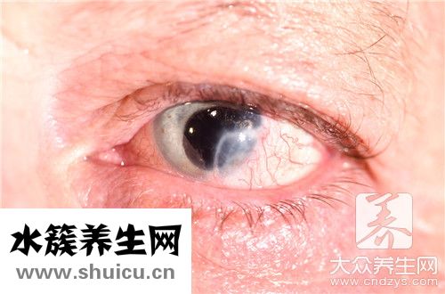 眼结膜