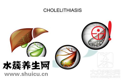 血清胆红素偏高