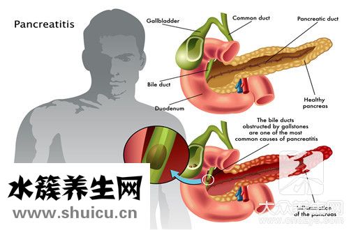 血清胆红素偏高