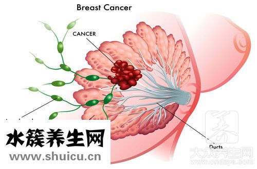 乳腺实性结节是什么