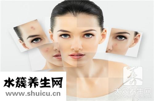 脸上一擦护肤品就过敏 脸上因擦护肤品过敏怎么办