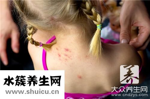 起疹子