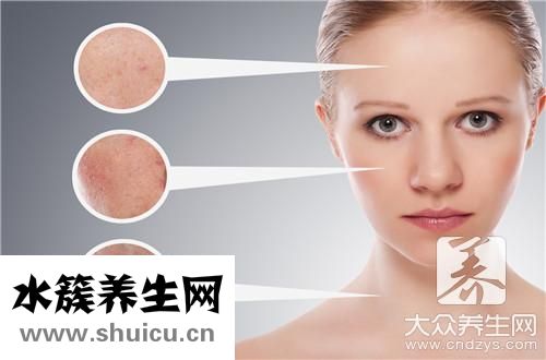 玫瑰痤疮治疗方法