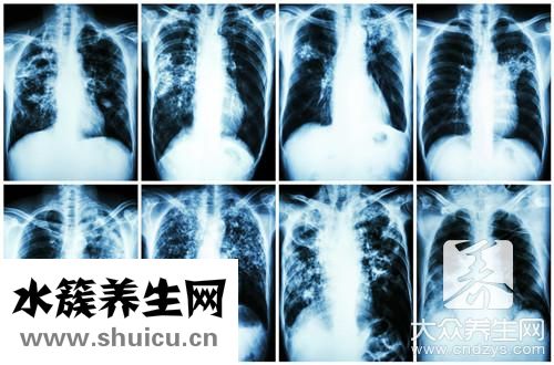 肺动脉压正常值