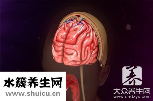 脑血管检查最佳方法