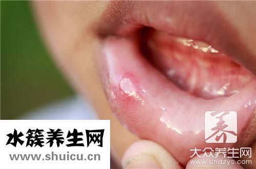 口腔常见疾病