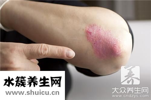 身体除湿最好的办法是什么？什么方法除湿效果最好，