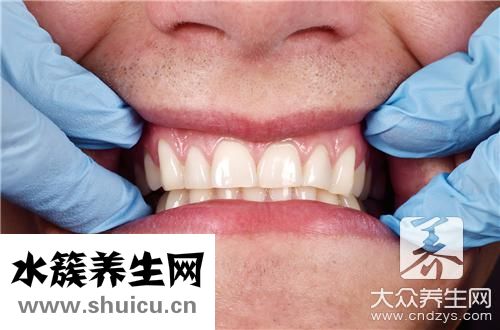 抽烟牙齿变黑办