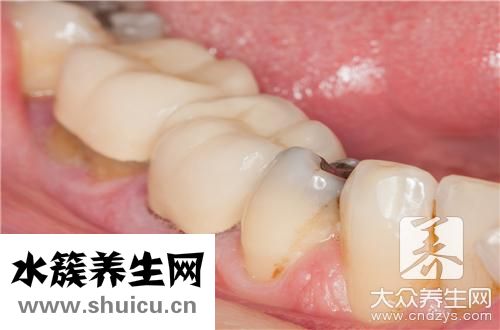 抽烟牙齿变黑办