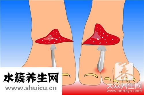 脚背肿