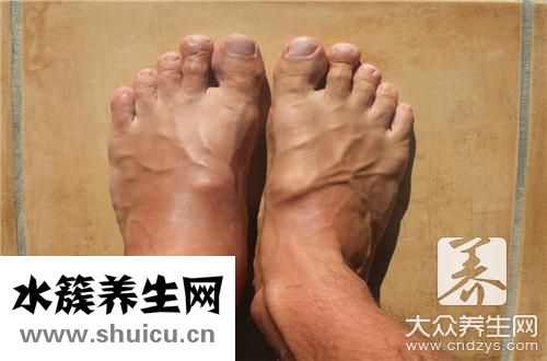 脚水泡