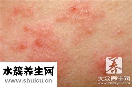 手掌长疙瘩