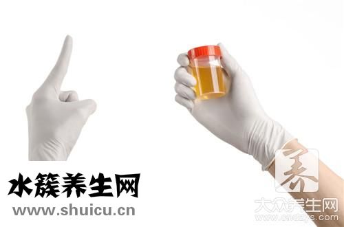粘液丝偏高