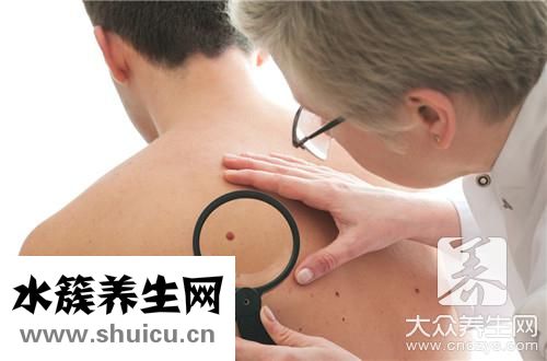 纤维脂肪瘤