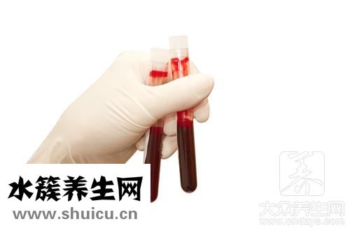 狂犬疫苗血清