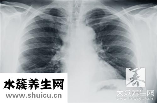 正常胸片和异常胸片