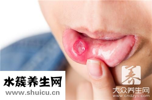 口腔厌氧菌感染症状