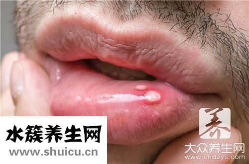 嘴里发咸