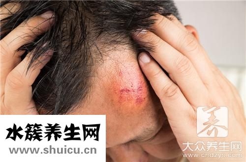 剧烈运动后头晕