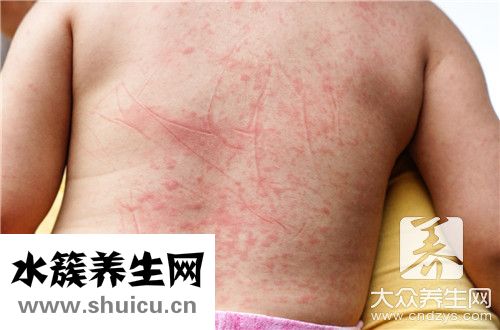 气滞血瘀最好中成药