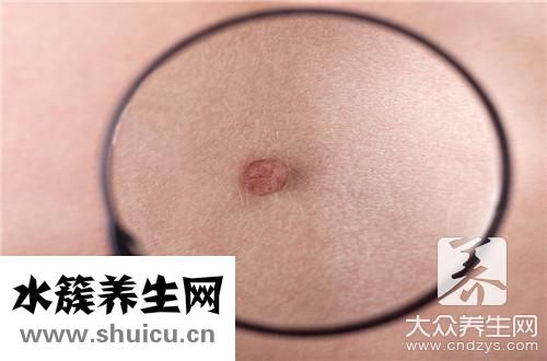 挤痘痘留下疤痕