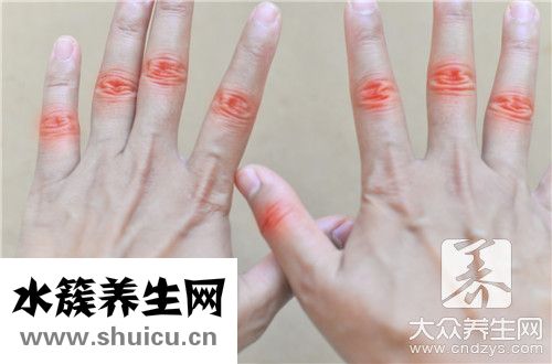实性结节