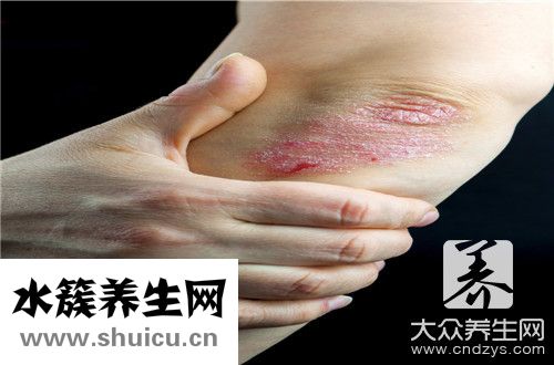 银霄病是什么引起