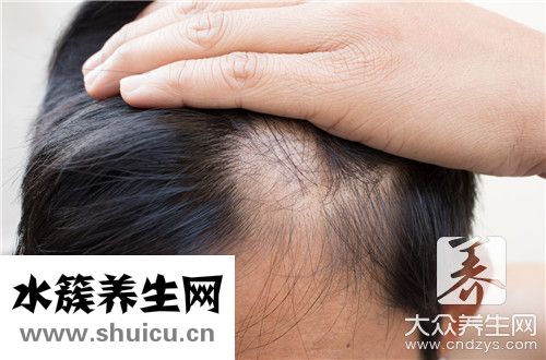 气血不足掉发办