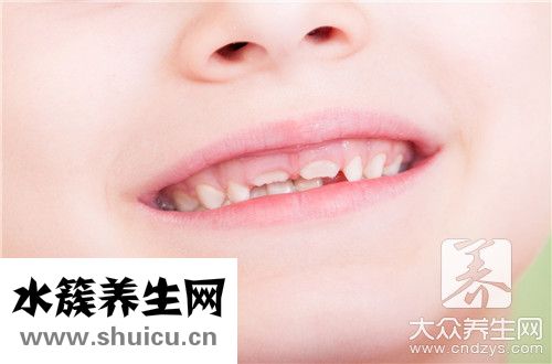 牙根漏出了恢复