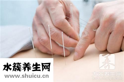 置留针