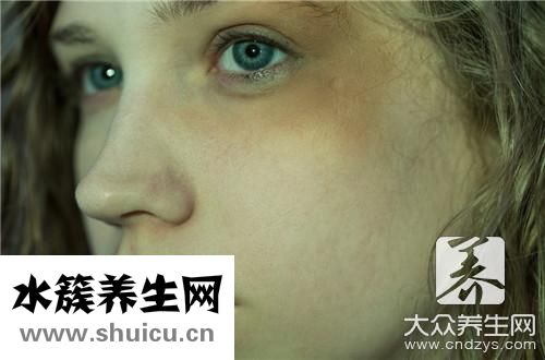黑色素沉积
