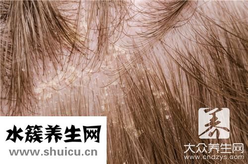 头皮问题
