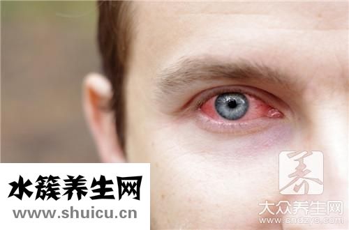过敏眼药水