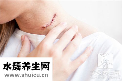 反应性增生
