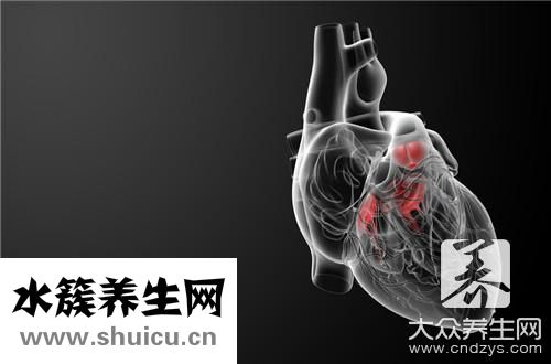 右位主动脉弓