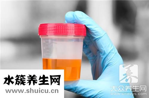 上厕所发现尿液很黄是怎么回事？上厕所发现小便黄…