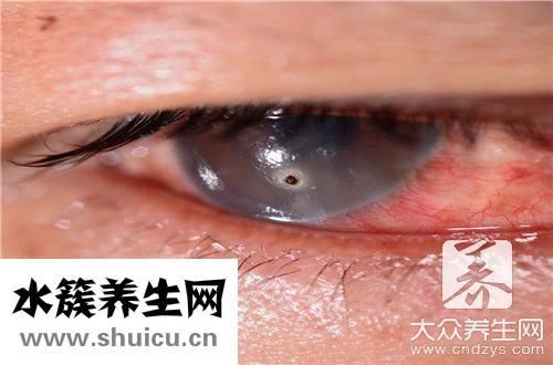 眼角干痒