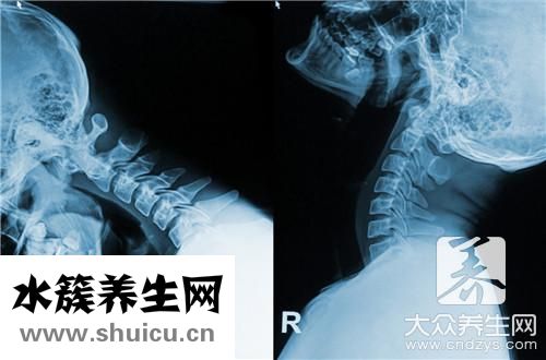 牵引疗法