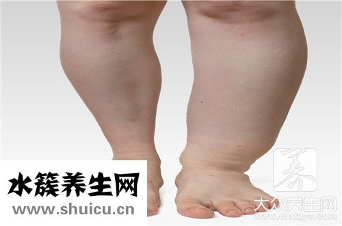 去水肿方法