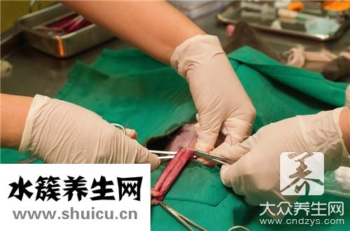结扎方法