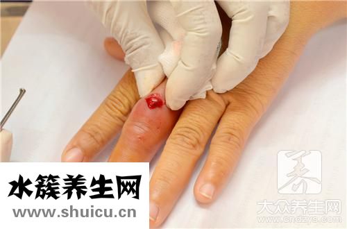 防水创可贴