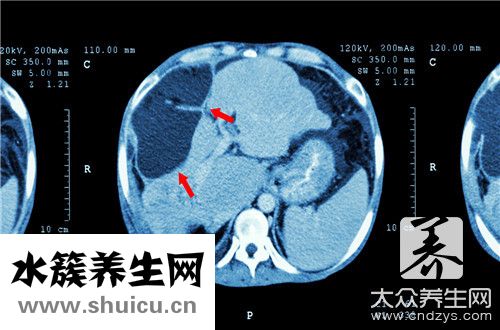 肝病看什么科