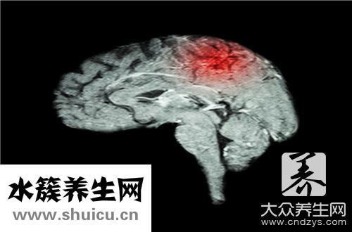 脑出血分期